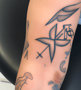 The Best Tattoo Removal in Brisbane