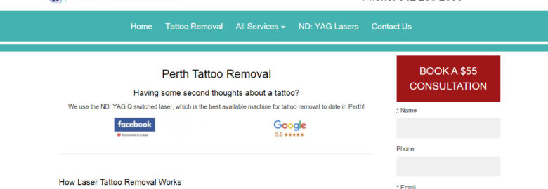 Second Thoughts Tattoo Removal