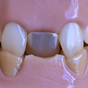 Prosthodontists in Australia